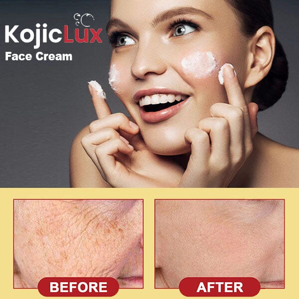 Kojic Acid Brightening Face Cream (50g) by KojicLux